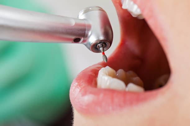 Best Broken or Chipped Tooth Repair in Greenville, NY